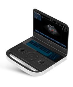 Premium 4D portable colour doppler. 2 Probe connectors, 2 screen with convex probe. Revo9