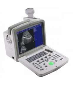 Ultrasound Scanner Wed-180